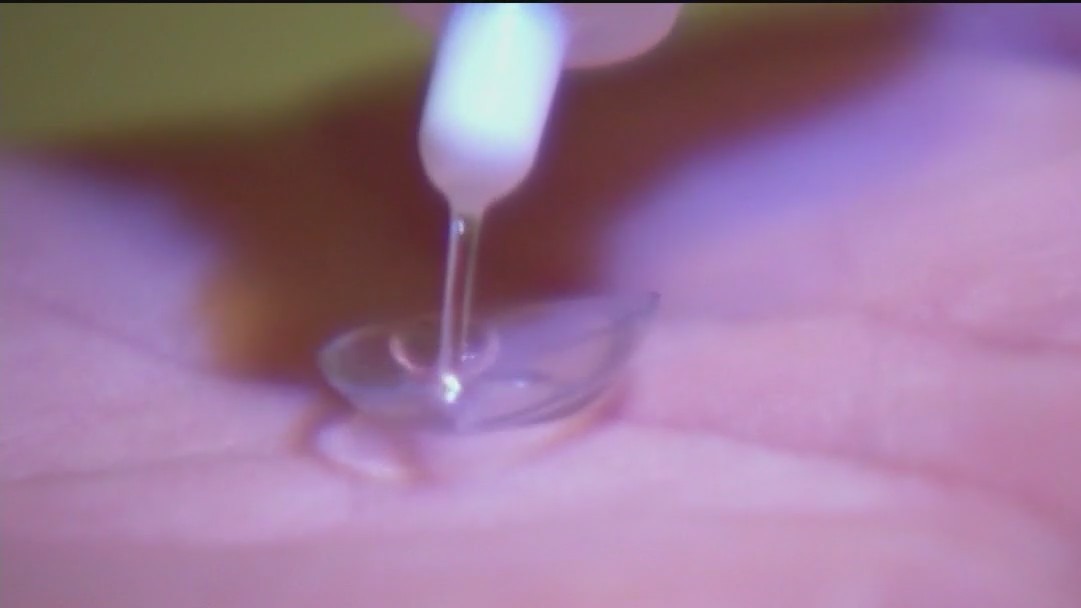 Allergies may be to blame for itchy eyes